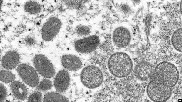 FILE - This 2003 electron microscope image made available by the Centers for Disease Co<em></em>ntrol and Prevention shows mature, oval-shaped mo<em></em>nkeypox virions, left, and spherical immature virions, right.